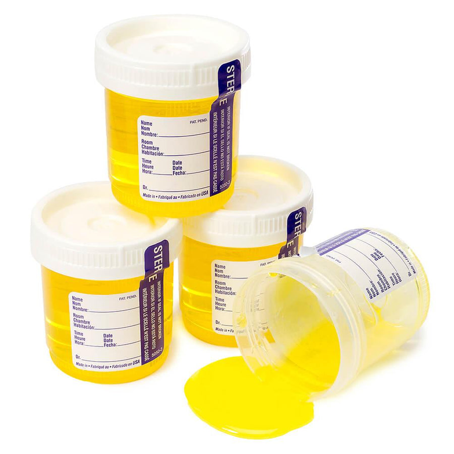 Tower of Sour Liquid Candy Urine Samples: 4-Piece Pack - Candy Warehouse